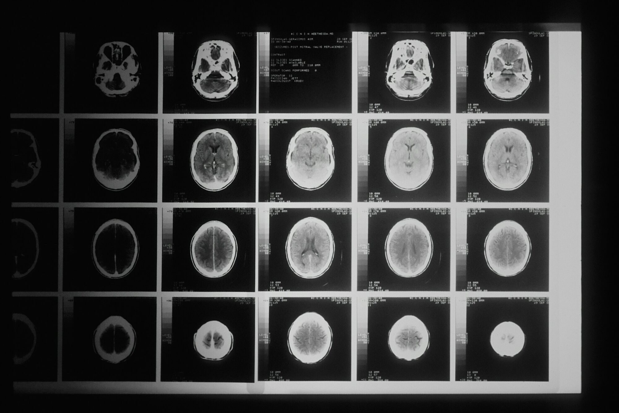 Imaging studies on a diagnostic display