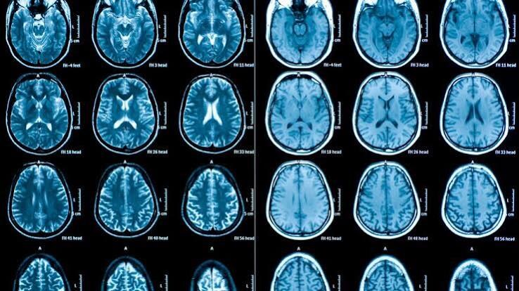 Diagnostic imaging study
