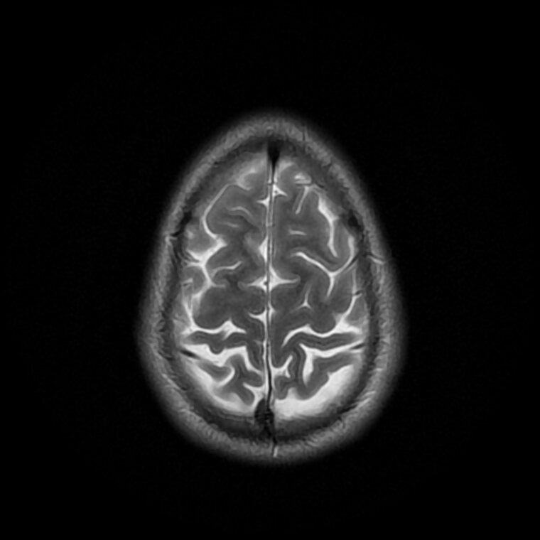MRI study
