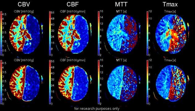Diagnostic imaging study